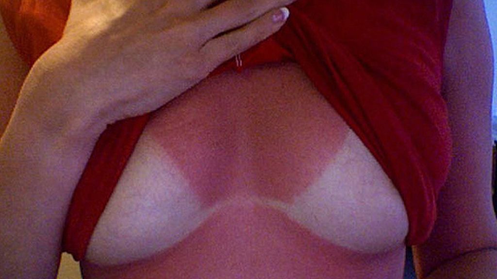 Cuando el sol te marca