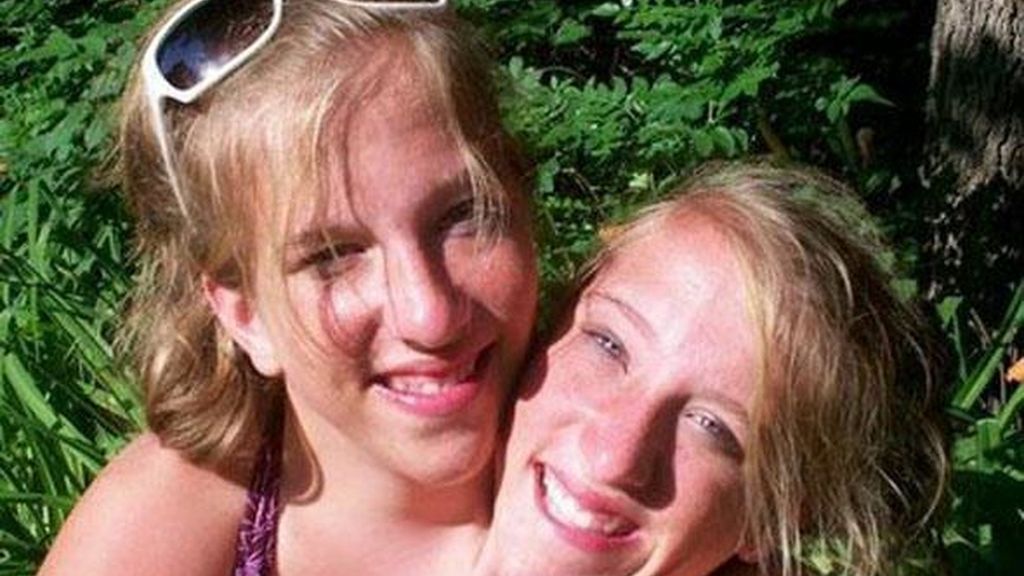 Abby y Brittany Hensel, de 22 años, son un caso raro de gemelos que se da uno entre un millón de millones