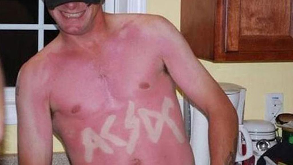 Cuando el sol te marca