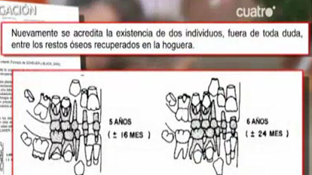 Piezas dentales de niños