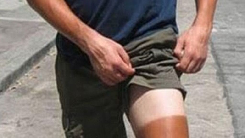 El bronceado, entre la belleza y el horror