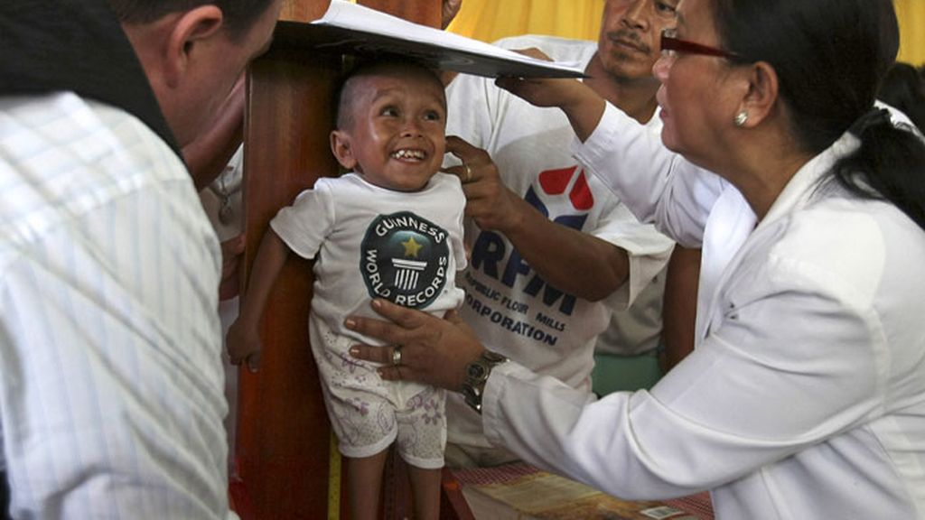 El hombre más pequeño del mundo