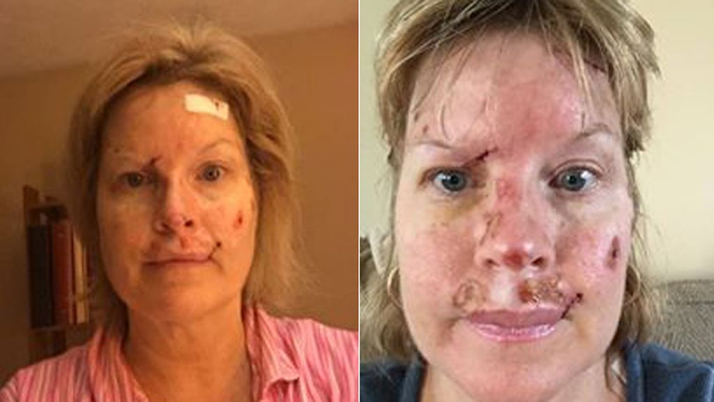 La lucha contra el cáncer de piel en imágenes