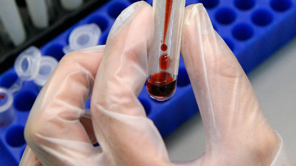 álisis de sangre puede predecir si vas a morir en los próximos cinco años