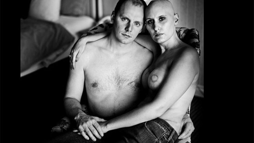 La fotos de supervivientes del cáncer de mama que Facebook no quiere mostrar