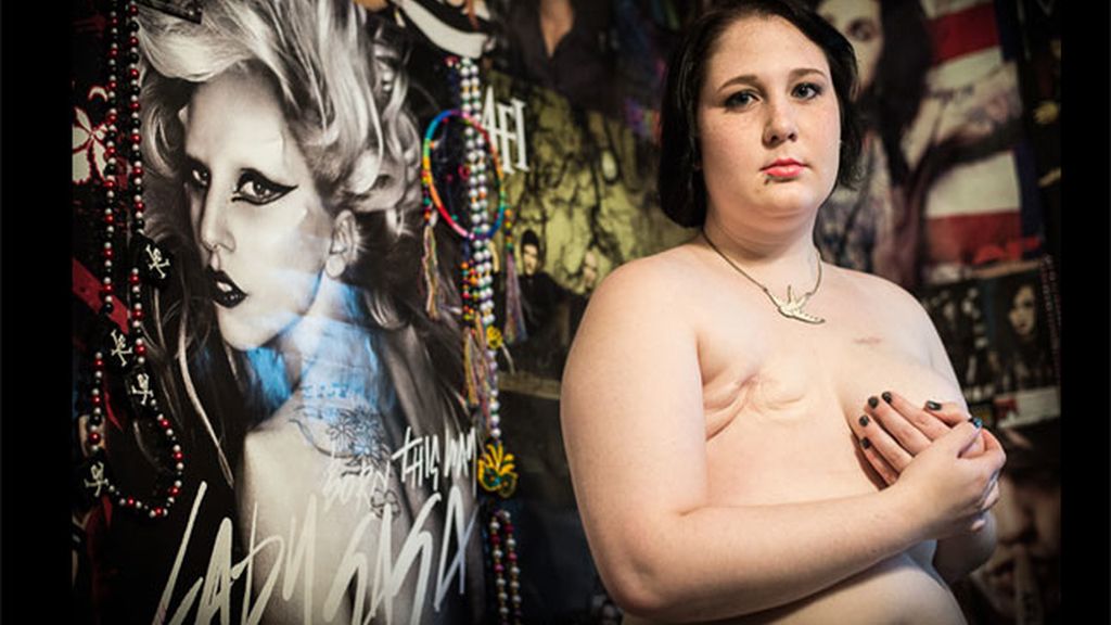 La fotos de supervivientes del cáncer de mama que Facebook no quiere mostrar