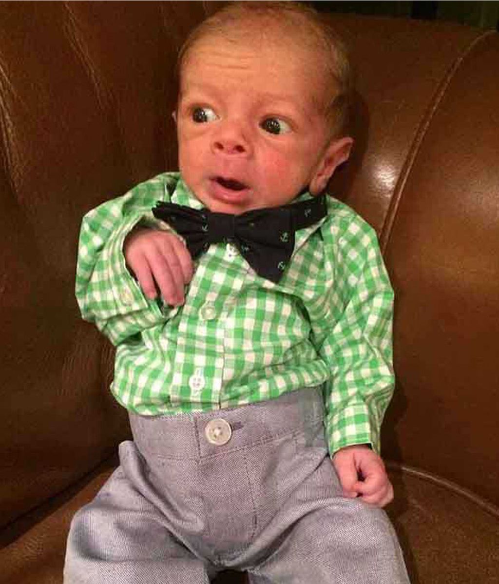 Recién nacidos con líneas de expresión