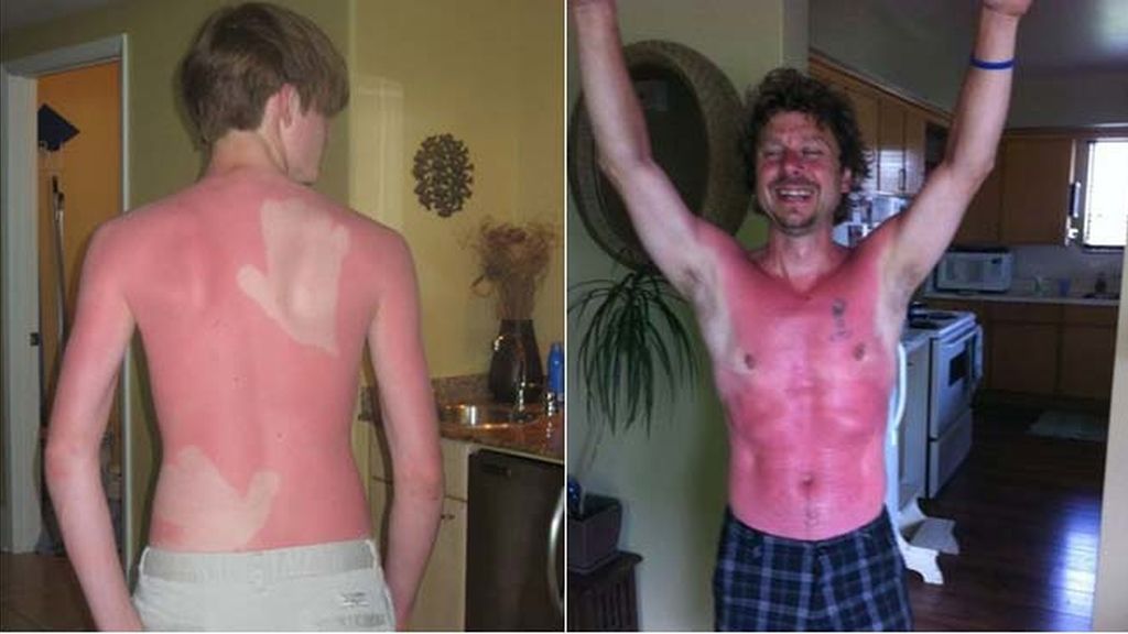 Cuando el sol te marca