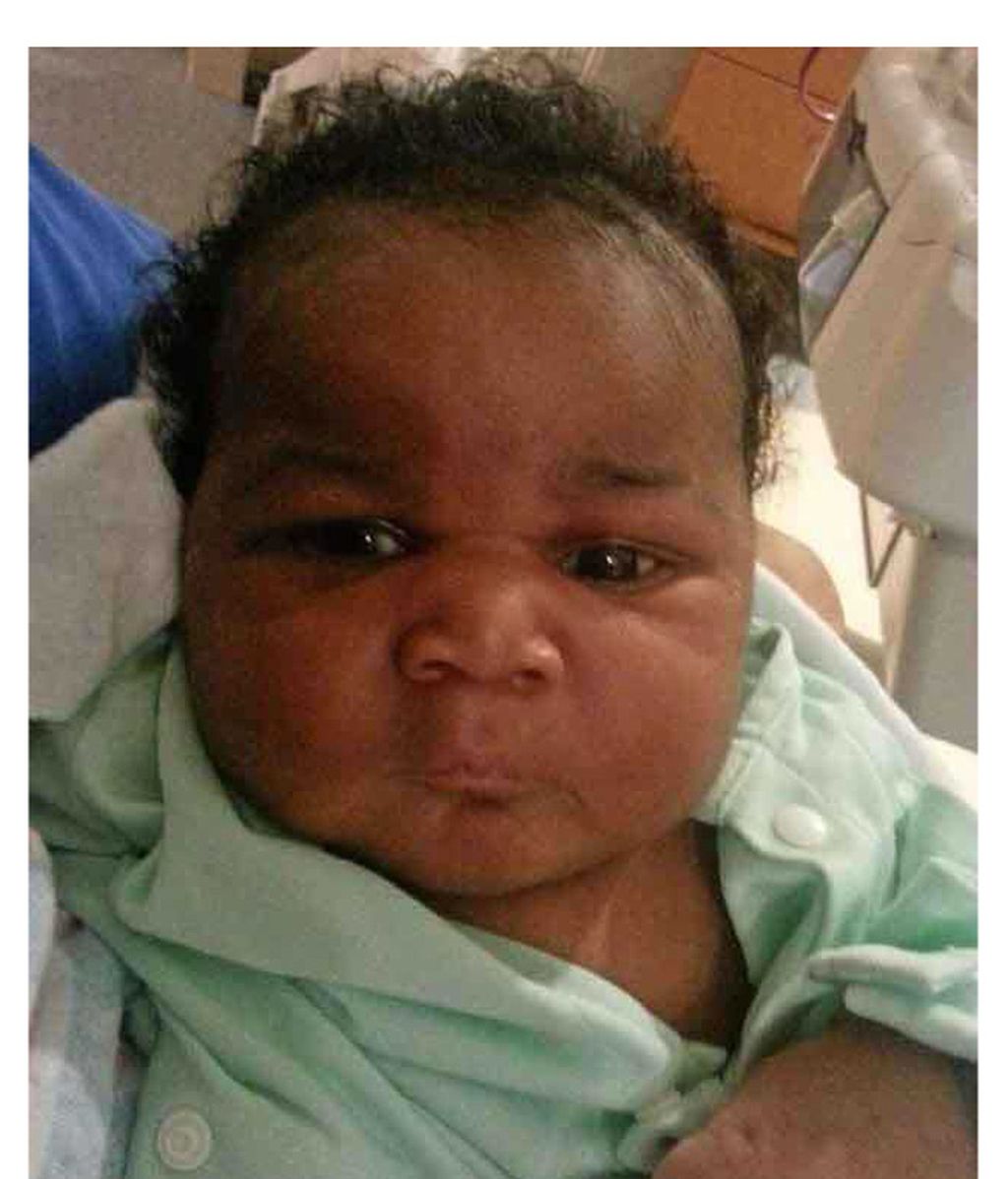 Recién nacidos con líneas de expresión