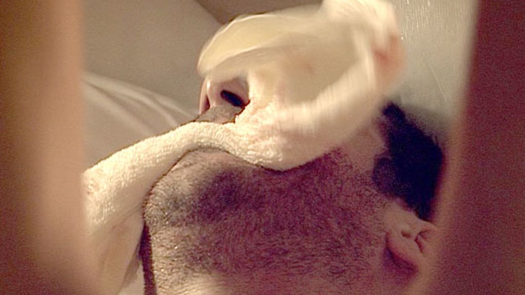 Duque, herido de bala