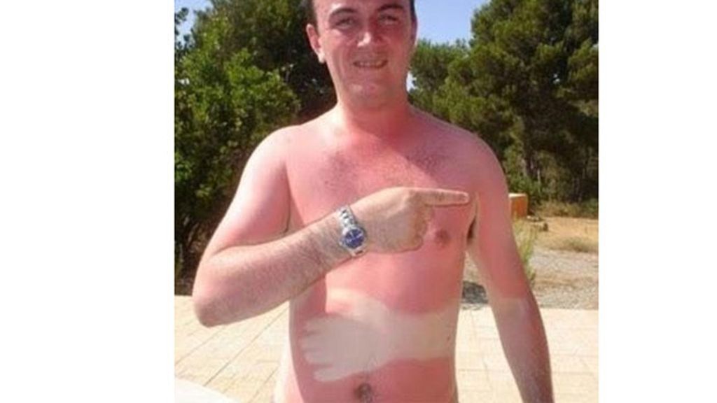 El bronceado, entre la belleza y el horror