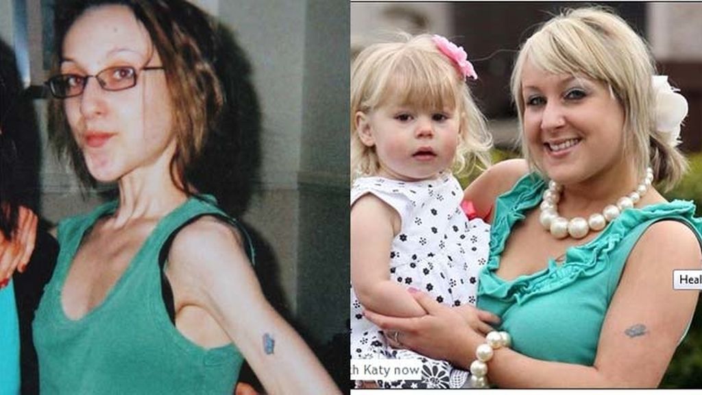 Su bebé le salvó de morir por la anorexia Su bebé le salvó de morir por la anorexia