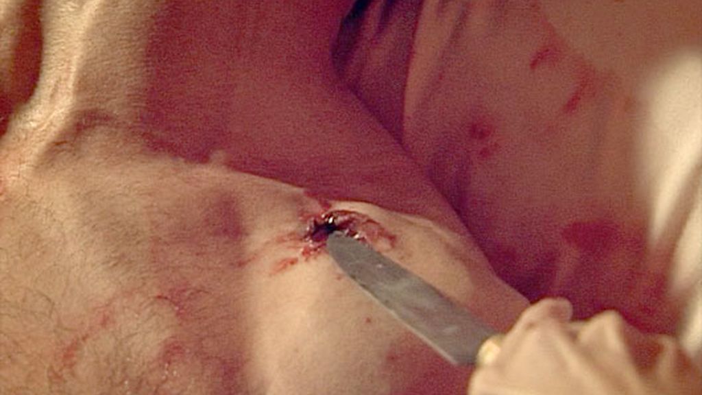 Duque, herido de bala