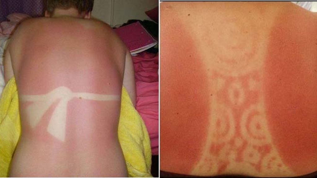 Cuando el sol te marca