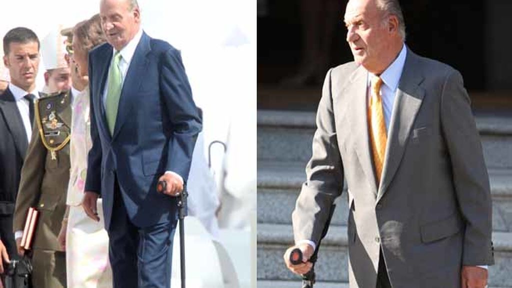 Rotura del tendón de Aquiles izquierdo