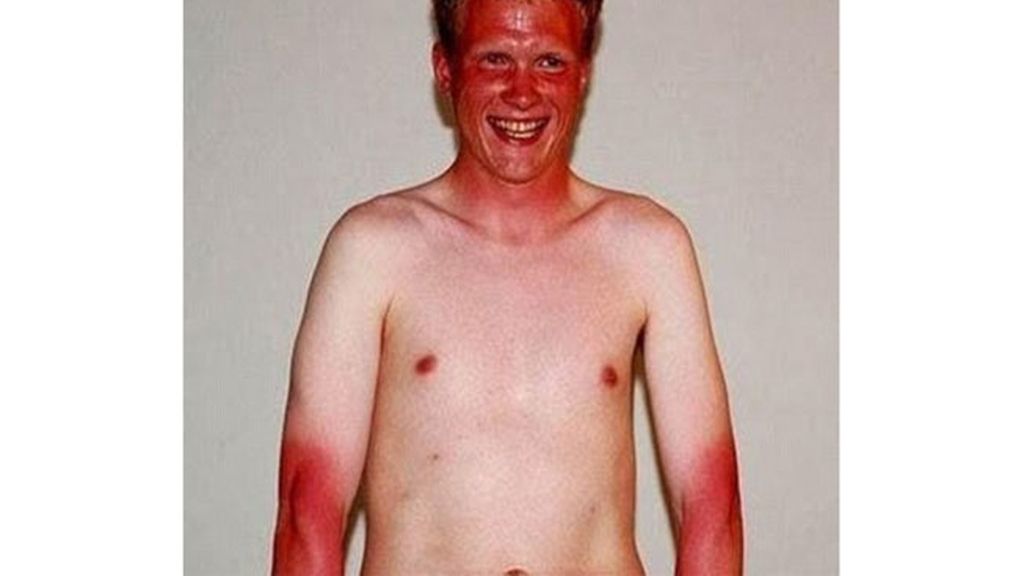 El bronceado, entre la belleza y el horror