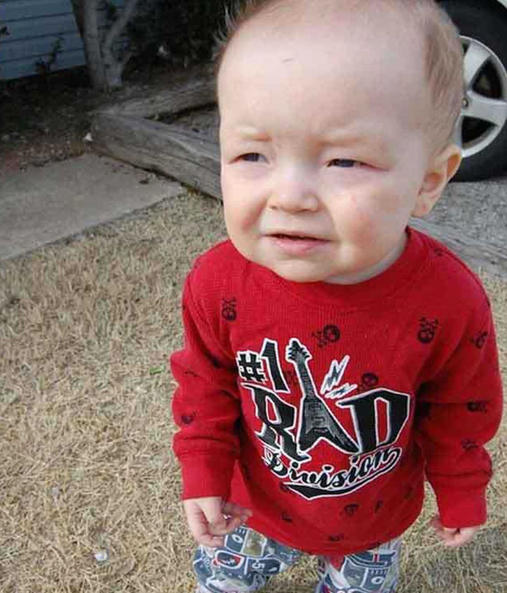 Recién nacidos con líneas de expresión