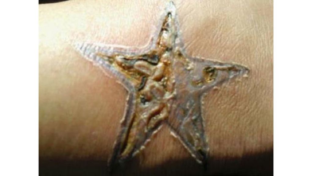 Cuando te tatúa un ‘chapucero’