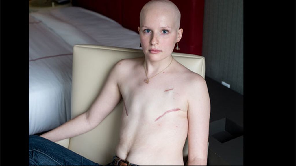 La fotos de supervivientes del cáncer de mama que Facebook no quiere mostrar
