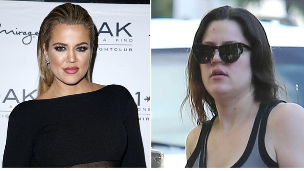 Khloe Kardashian