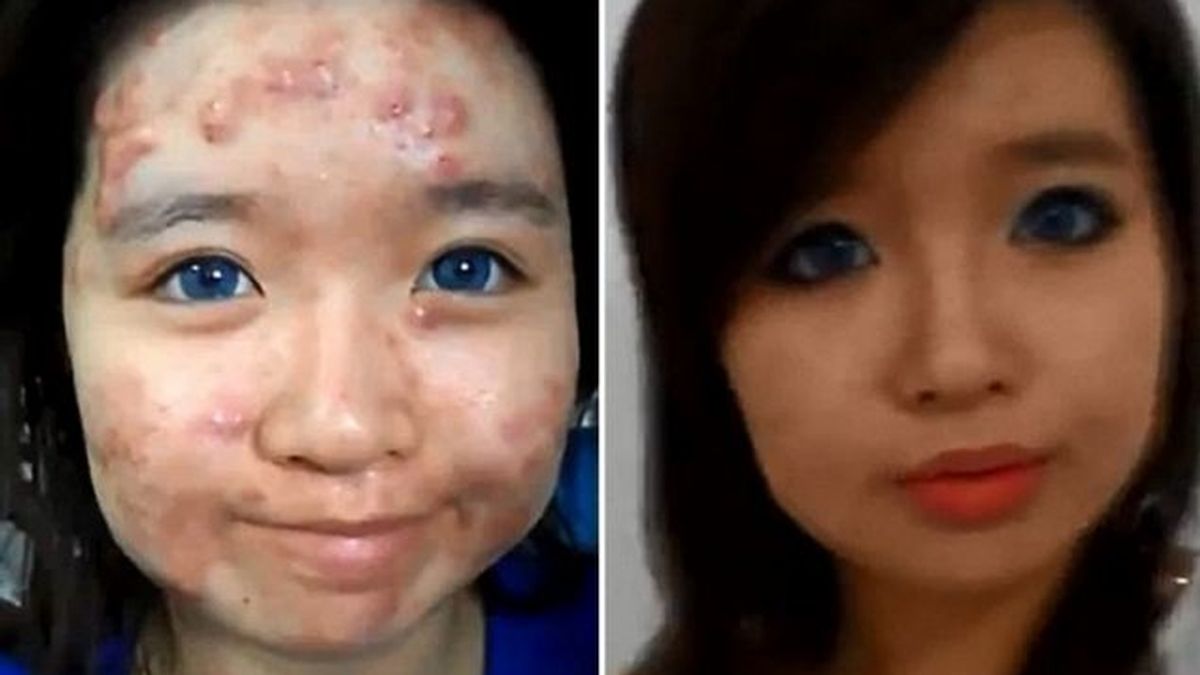 Elaine Mokk da consejos de maquillaje para tapar el acné