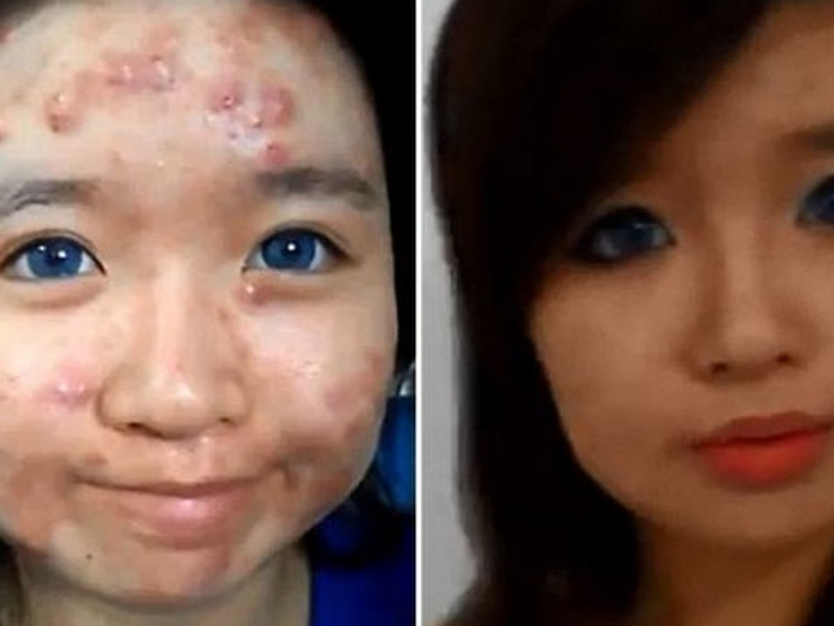 Consejos de maquillaje para tapar el acné, con más de seis millones de  visitas