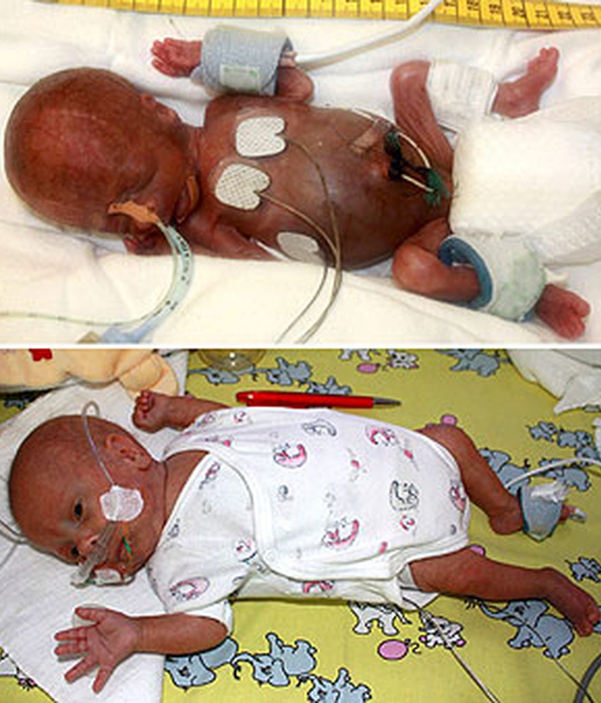El neonato pesa un poco más de un cuarto de kilo. Foto: EFE.