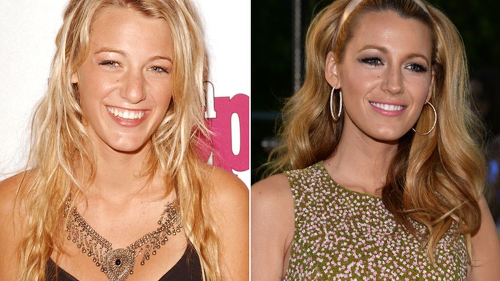 Blake Lively (27) le debe gran parte de su éxito al trabajo de su cirujano