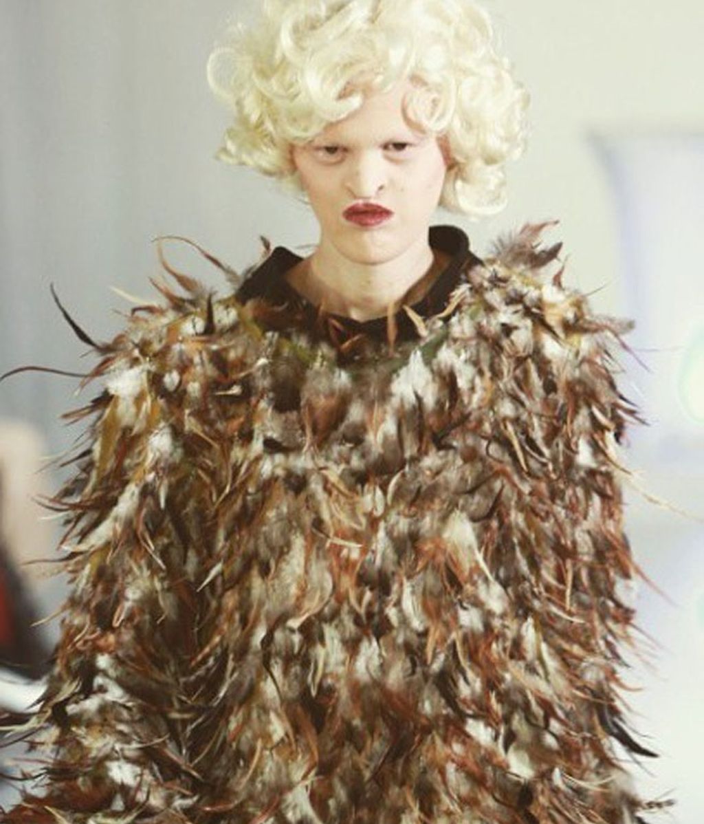 Melanie Gaydos, del complejo por su Displasia Ectodérmica a la pasarela