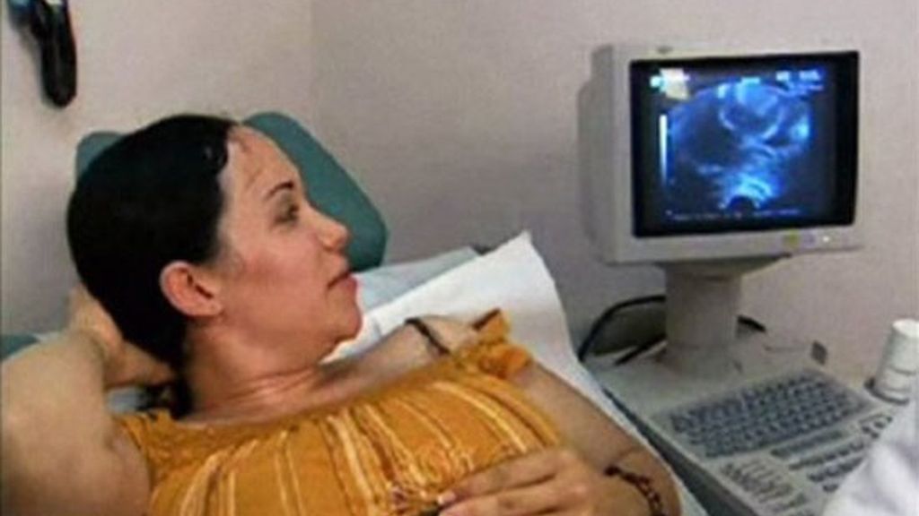 La madre de los octillizos