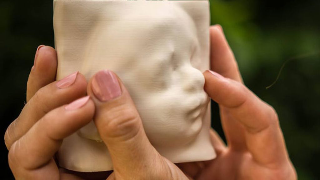 Los padres con discapacidad visual ya pueden ‘ver’ a sus hijos antes de nacer Los padres con discapacidad visual ya pueden ‘ver’ a sus hijos antes de nacer