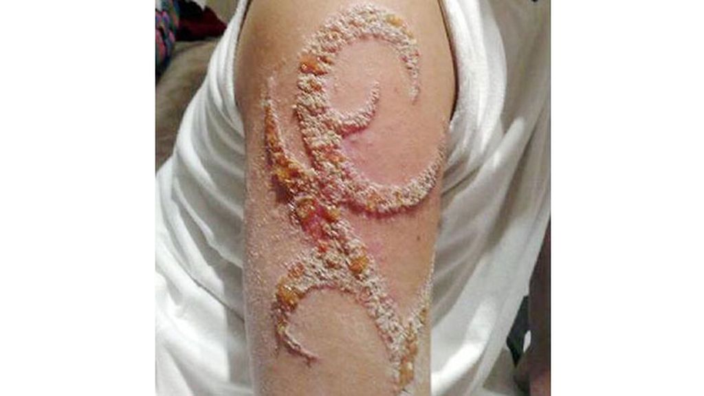 Cuando te tatúa un ‘chapucero’