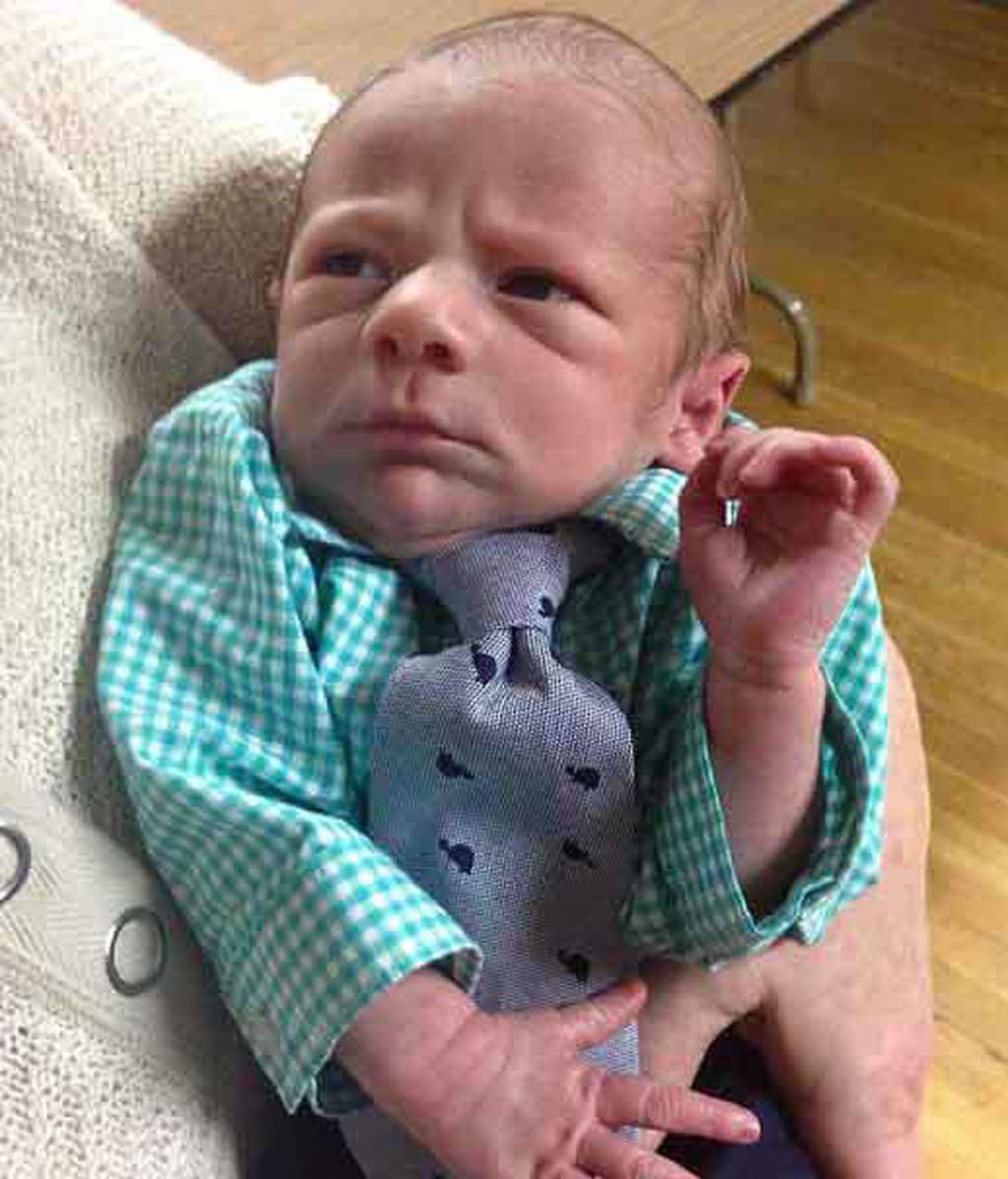 Recién nacidos con líneas de expresión