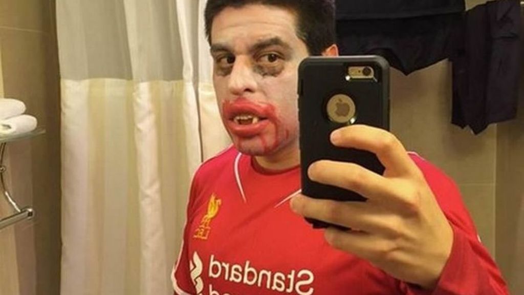 Muchos aprovecharon la noche de Halloween para sacar los dientes
