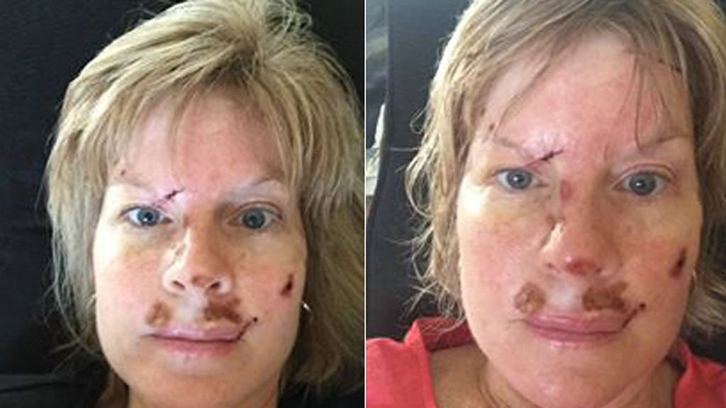 La lucha contra el cáncer de piel en imágenes