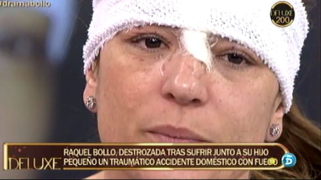 Las secuelas físicas de Raquel Bollo