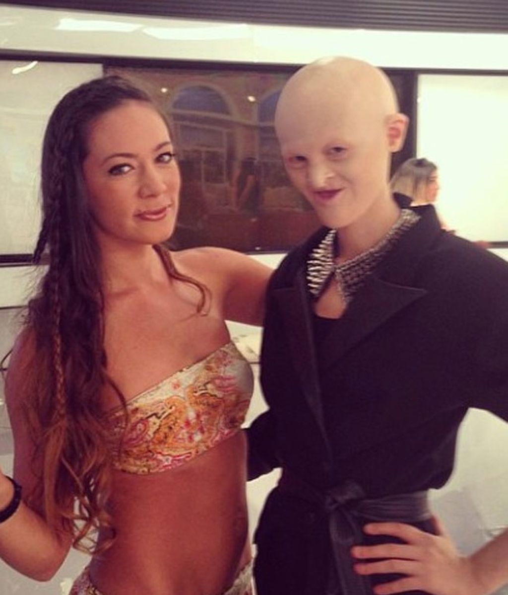 Melanie Gaydos, del complejo por su Displasia Ectodérmica a la pasarela