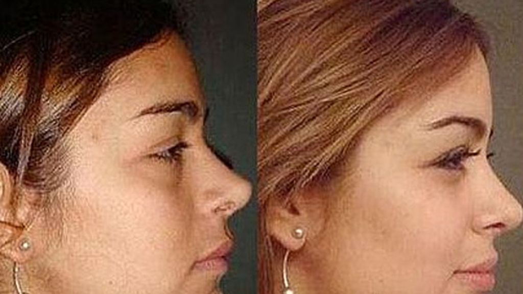 Larissa Riquelme, menos guapa de lo que parece