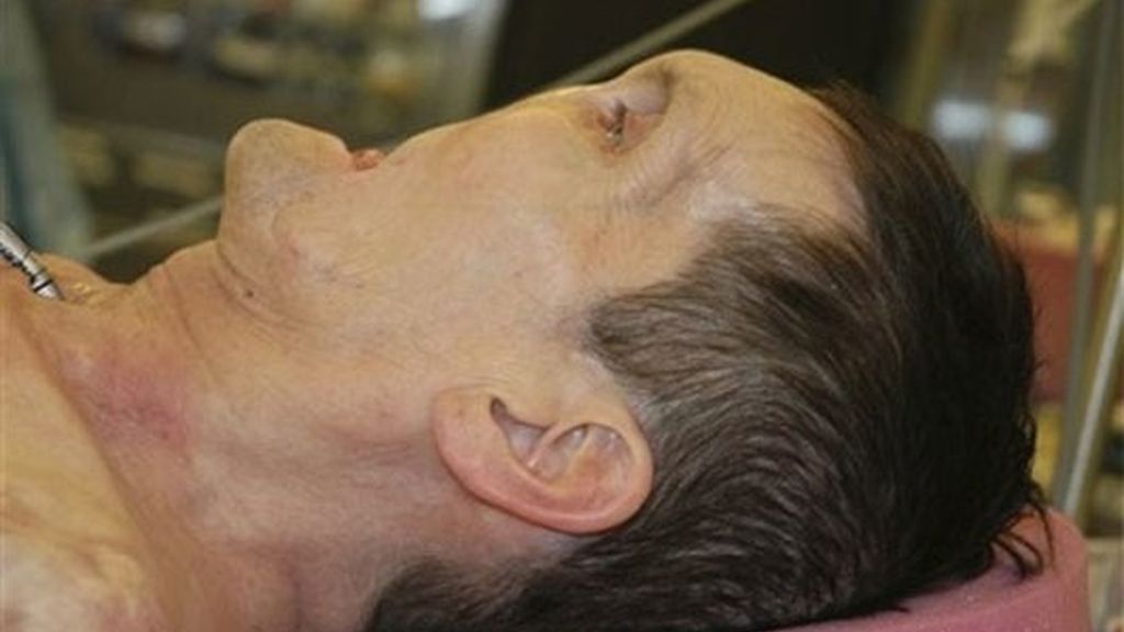 ANTES DE LA OPERACIÓN