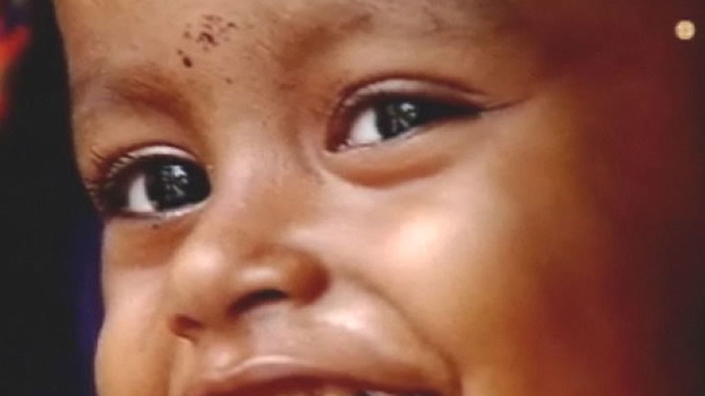 Los padres de esta niña india, lejos de querer operarla, consideran que se trata de una reencarnación divina