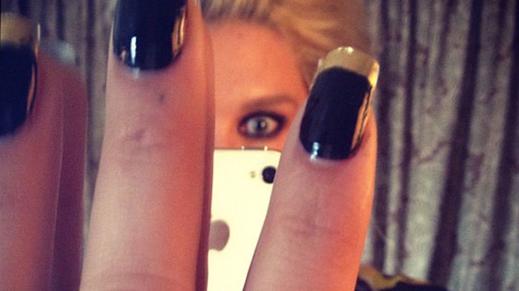 Kesha