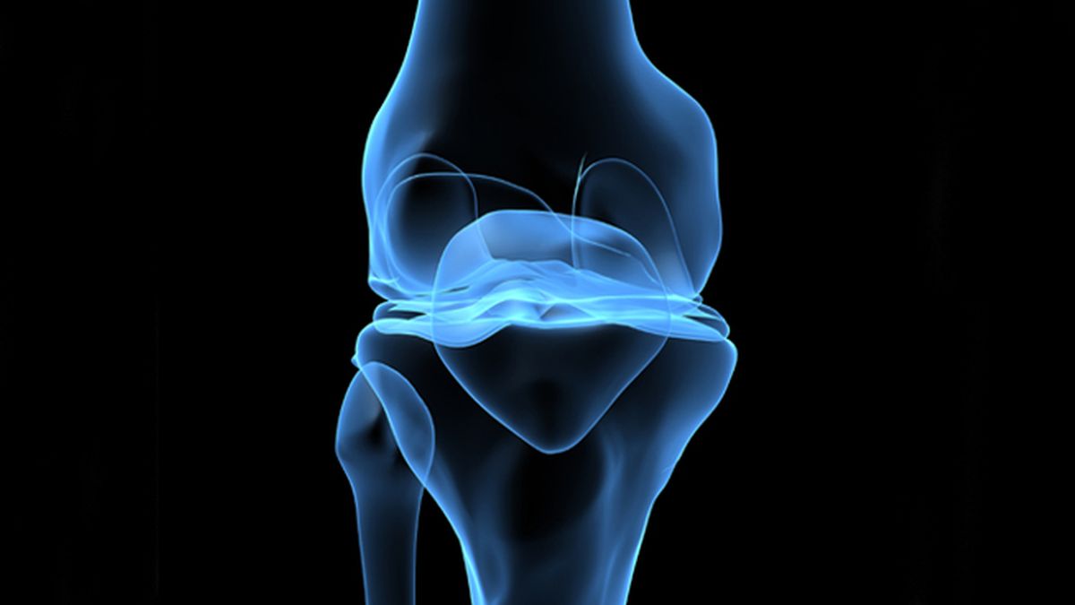 Una terapia logra ralentizar la progresión de la artrosis de rodilla