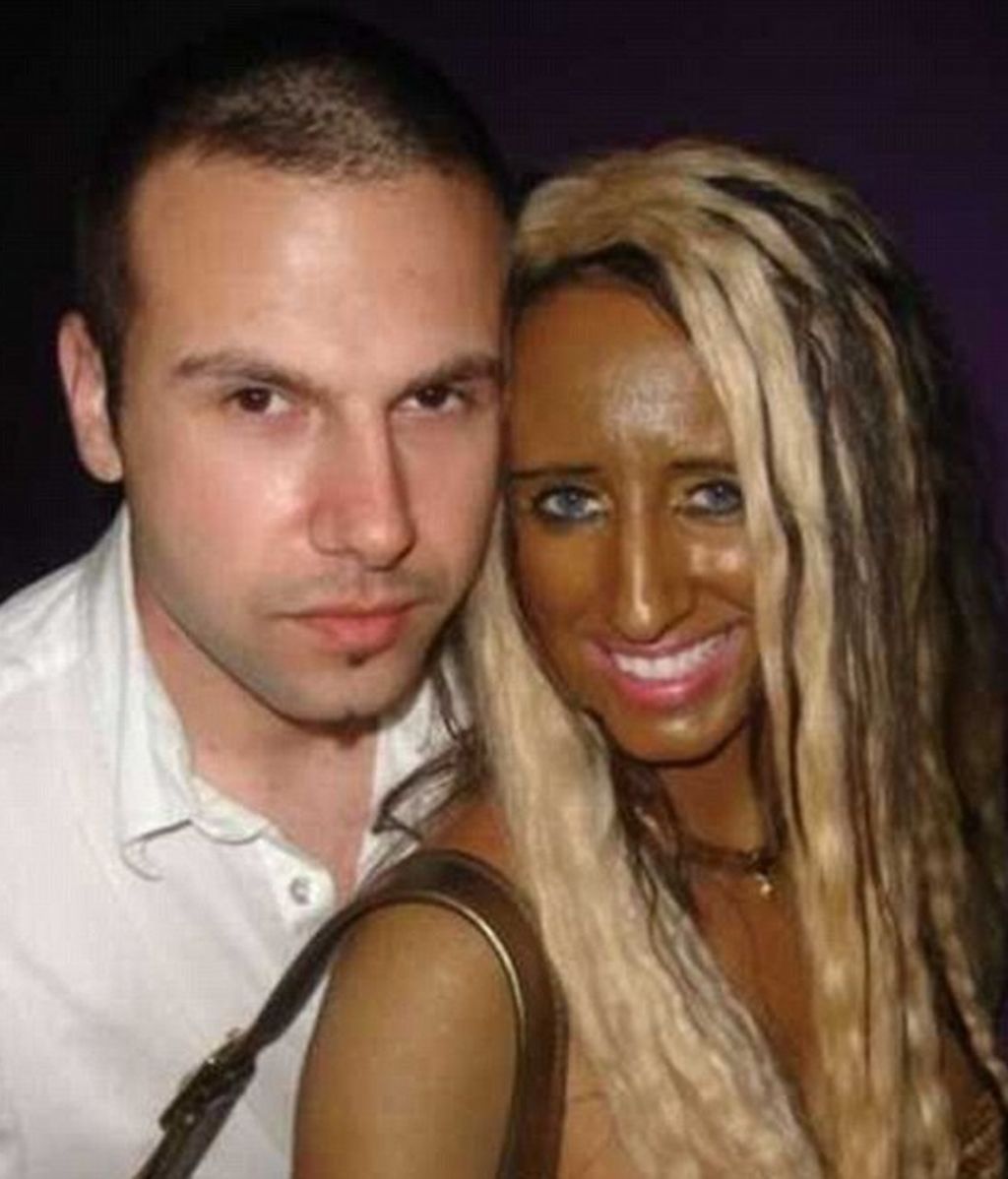 El bronceado, entre la belleza y el horror