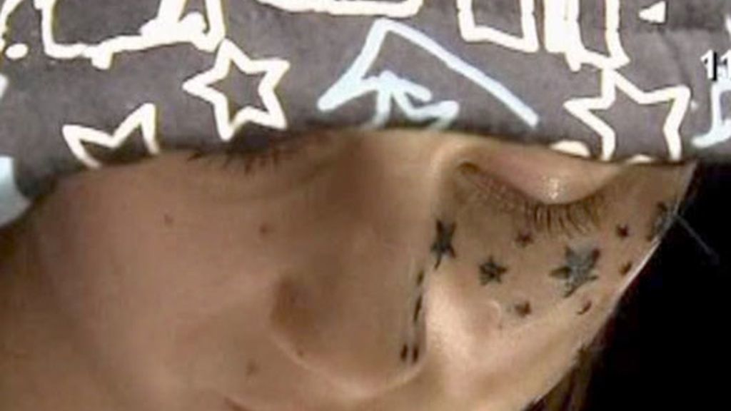 La Costra Del Tatuaje Se Cae Sola