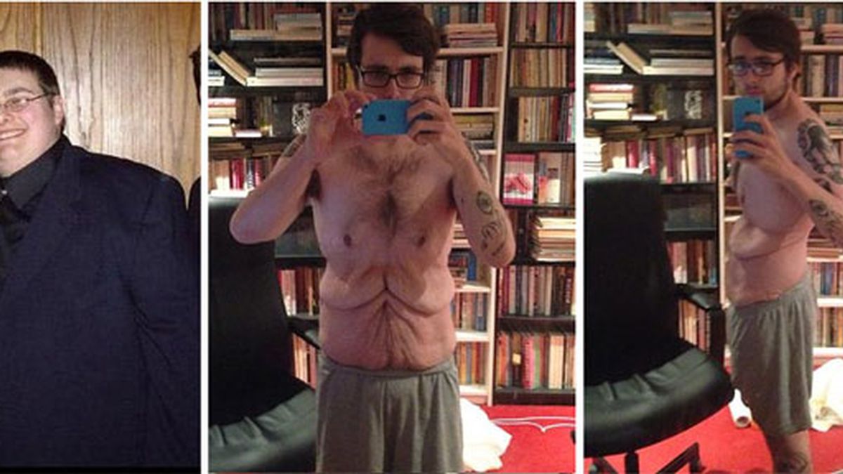 John Burton exhibe su cuerpo tras perder más de 110 kilos en tres años