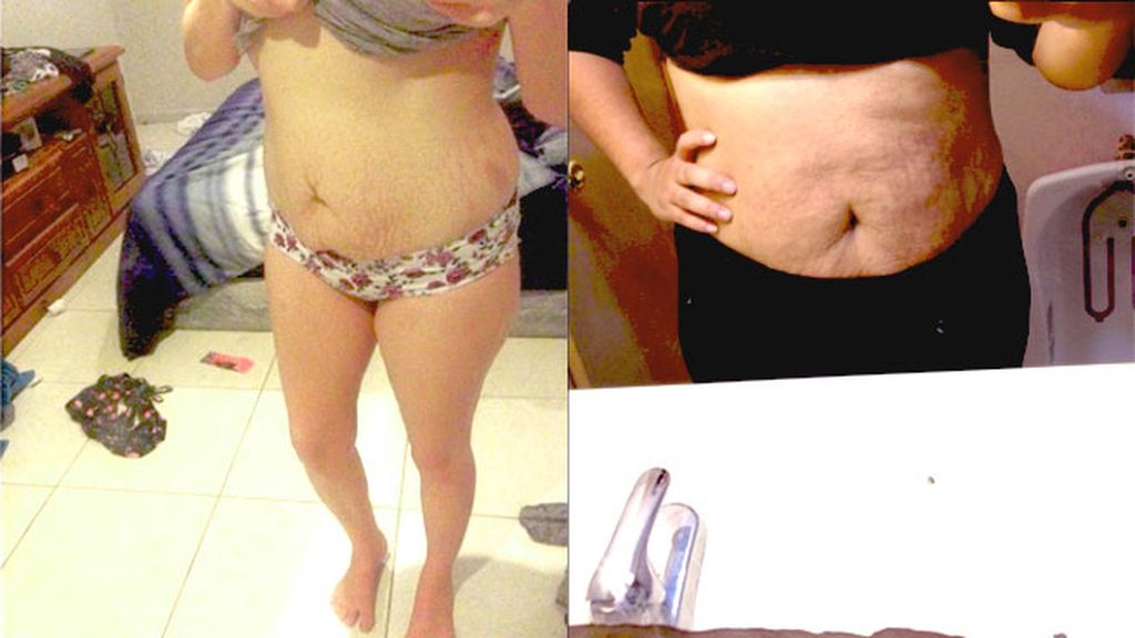 Sin complejos tras el emabrazo