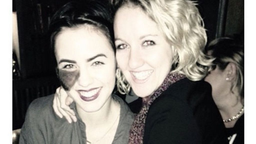 Nació con un lunar en su cara que la hace especial