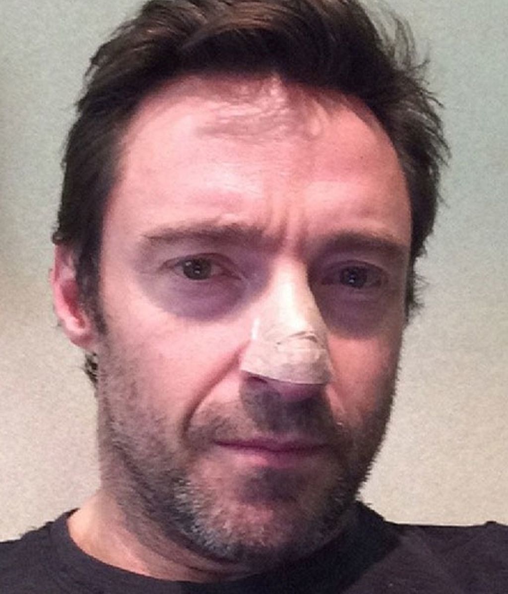 hugh jackman