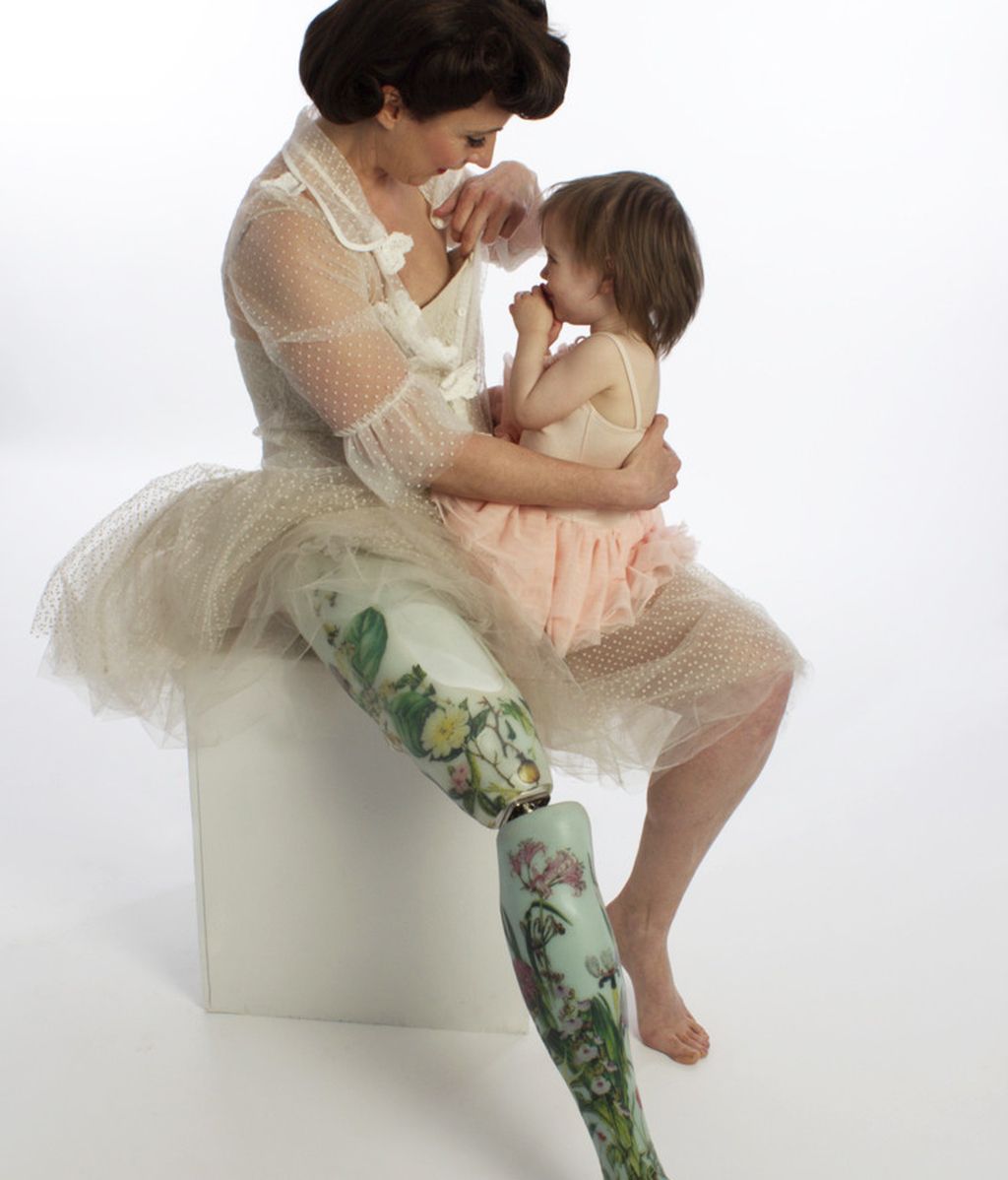 Llegan las prótesis 'fashion', el arte impone su sello