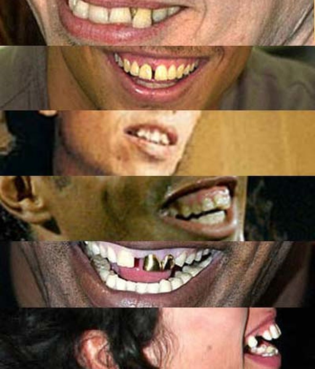 Ponte brackets Ponte brackets